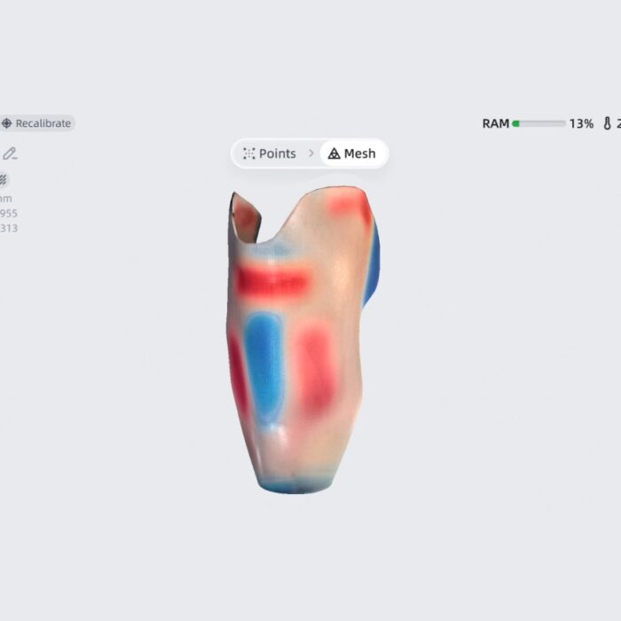 3D сканер Shining 3D EinScan Medixa фото 3 3D сканер Shining 3D EinScan Medixa — ручной 3D-сканер, ракурс 3
